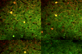 Neurons in the primary visual cortex of an awake mouse