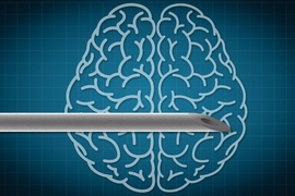 Professor Michael Cima and his colleagues are now designing brain implants that can not only deliver electrical stimulation but also record brain activity or deliver drugs to very targeted locations.