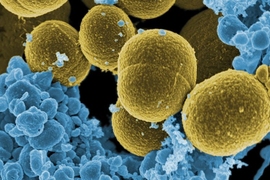 S. aureus bacteria and human white blood cells.
