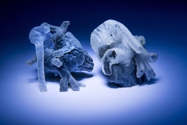 New system from MIT and Boston Children’s Hospital researchers converts MRI scans into 3D-printed heart models (shown here). 