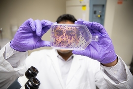Tushar Kamath counts stained cells after treatment with a drug.