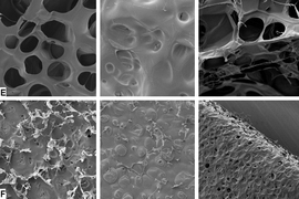 This scanning electron microscope images show the detailed inner structure of hydrogels made from tropoelastin, from different parts of the structure. From right to left, you can see the top, bottom and edges of the material.