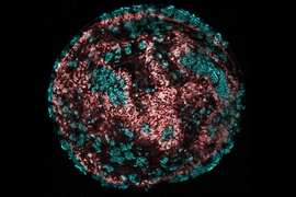 This image shows large clonal colonies of cochlear progenitor cells formed from single cells and converted into high-purity colonies of hair cells (cyan) with intricate hair bundles (red).