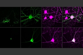 MIT researchers have devised a way to control single neurons using optogenetics. To help achieve this, they developed an opsin, or light-sensitive protein, that can be targeted to neuron cell bodies (bottom row). Neurons in the top row have traditional opsins that are distributed throughout their axons.
