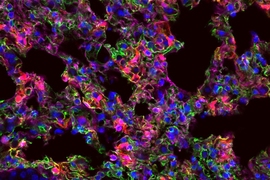 MIT researchers have designed nanoparticles that can deliver messenger RNA to specific organs. In this image, lung cells expressing the synthetic mRNA show up as red.