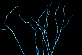 MIT neuroscientists can now record electrical activity from the dendrites of human neurons.