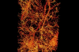 A subset of pyramidal neurons (orange) in the mouse primary somatosensory cortex. The dendritic spines associated with the postsynaptic protein Homer1 are highlighted in yellow.