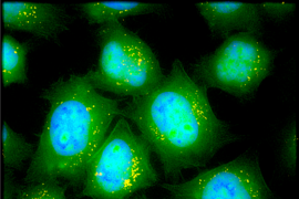 MIT researchers have designed inhalable particles that can deliver messenger RNA. These lung epithelial cells have taken up particles (yellow) that carry mRNA encoding green fluorescent protein.