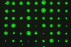 MIT biological engineers have developed a way to rapidly measure cell survival rates by growing many cell colonies and imaging their fluorescently labeled DNA.