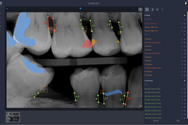 annotated dental X-ray