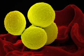 Closeup of 4 yellow spherical bacteria with bumpy surfaces. Background is red, organic shape.