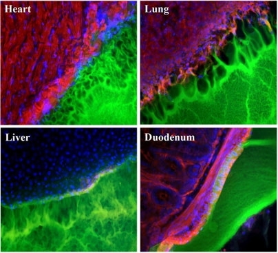 Images showing the interface between a surgical glue (green) and tissue samples (red, blue and black) from the heart, lung, liver, and duodenum. The glue works best with duodenum tissue (note smooth interface), and worst with lung tissue (pockmarked with holes).