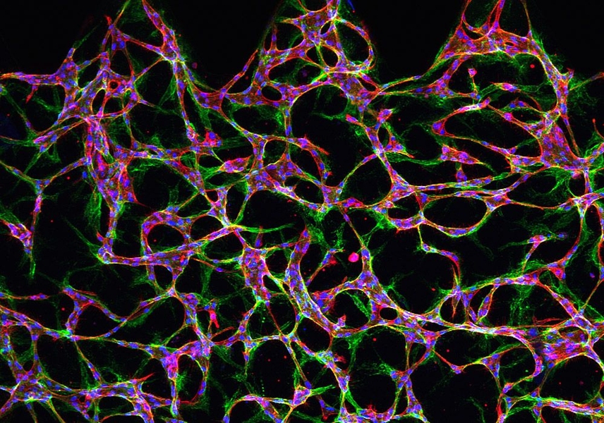 A microscopic image of endothelial cells suspended in a central region of a microfluidic device, showing the initial stages in the formation of a network of vessels.