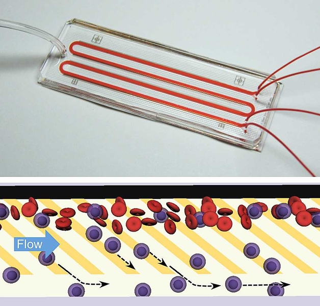 A microfluidic chip, like the one shown above, directly separates neutrophils from blood with ultrahigh purity and high efficiency without the need for cumbersome sample preparation. The chip works by mimicking the physiological process of 'cell rolling' where patterns of adhesive molecules are used to draw out neutrophils (blue) from a stream of blood (red) into a parallel buffer stream a...