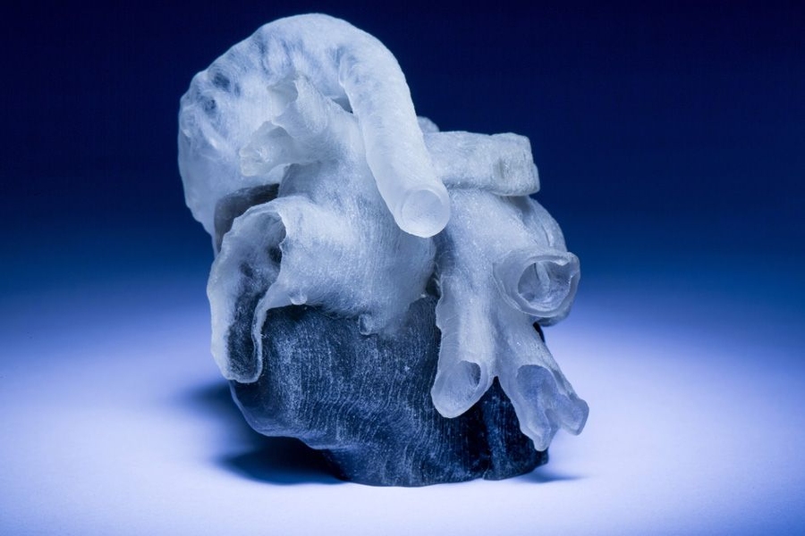 New system from MIT and Boston Children’s Hospital researchers converts MRI scans into 3D-printed heart models (shown here).