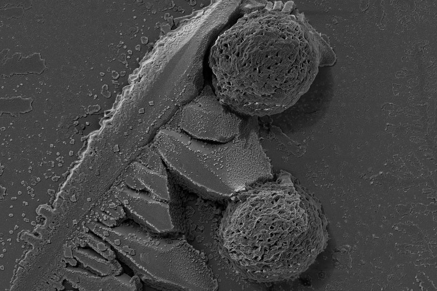 A close-up of spheres containing many microRNA strands.