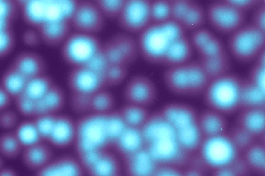 <i>Bacillus subtilis,</i> a commonly studied soil bacteria, survives at much lower cell density when it self-organizes into patches than when it is more evenly spread through its environment, new research by MIT postdoc Christoph Ratzke and Latham Family Career Development Associate Professor of Physics Jeff Gore shows.