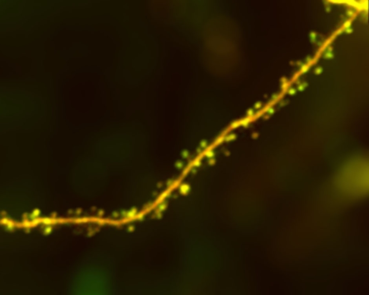 A dendrite with round processes or spines, expresses a red fluorescent protein together with a green tag for the protein Arc, obtained with two-photon microscopy.