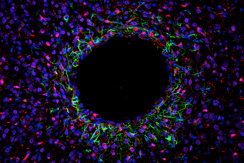 MiNDS probes developed at MIT cause minimal injury to brain tissue. This image shows minimal tissue scarring (green and red stains) and healthy neuron growth (purple) surrounding an implant.