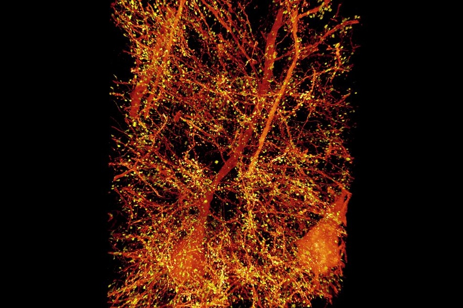 A subset of pyramidal neurons (orange) in the mouse primary somatosensory cortex. The dendritic spines associated with the postsynaptic protein Homer1 are highlighted in yellow.