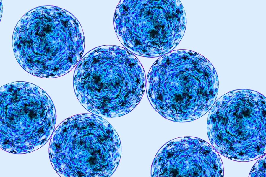MIT engineers have devised a way to incorporate crystallized immunosuppressant drugs into devices carrying encapsulated islet cells, which could allow them to be implanted as a long-term treatment for diabetes.