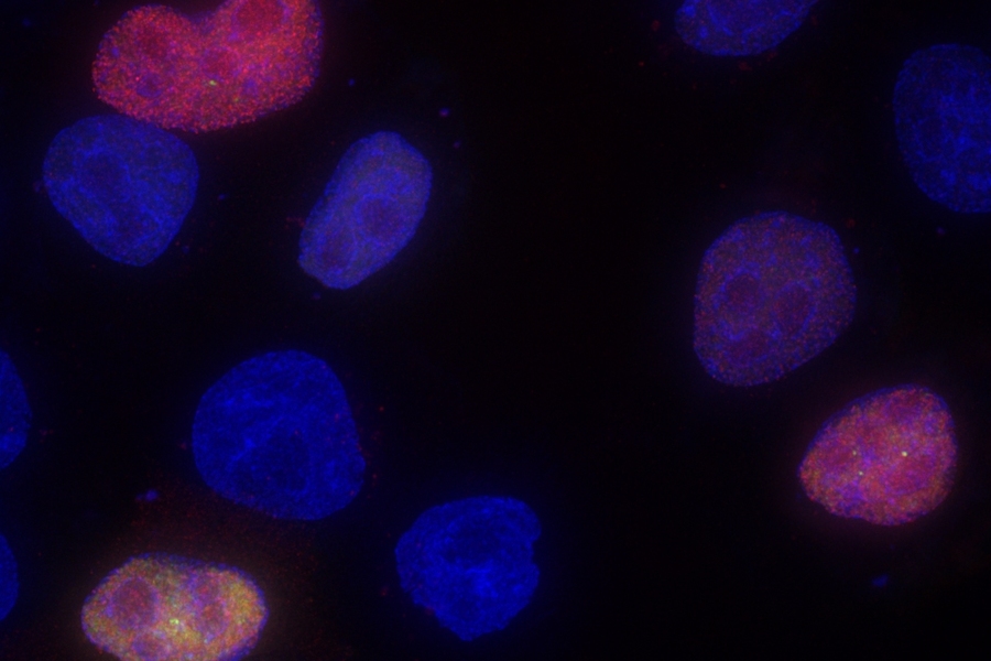 Cells transfected with fluorescent genes have different colors depending on their splicing patterns.