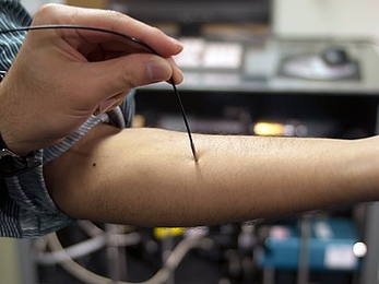 MIT researchers have devised a way to measure blood glucose levels by shining near-infrared light on the skin.