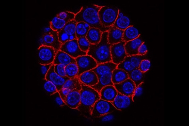 Pancreatic cancer cells (nuclei in blue) growing as a sphere encased in membranes (red). By growing cancer cells in the lab, researchers can study factors that promote and prevent the formation of deadly tumors.