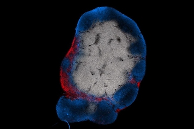 MIT engineers have devised a way to stimulate T cells (shown in red) to attack tumors by activating them with a vaccine that accumulates in the lymph nodes. B cells in the lymph nodes are labeled in blue.