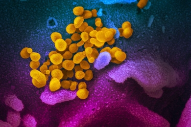 This scanning electron microscope image shows SARS-CoV-2 (yellow)—also known as 2019-nCoV, the virus that causes COVID-19—isolated from a patient, emerging from the surface of cells (blue/pink) cultured in the lab.