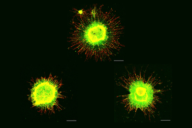 On a black background, one bright green ball of cells appears above two others. The top and bottom right one have long spikes radiating out. The bottom left one does not have those spikes.