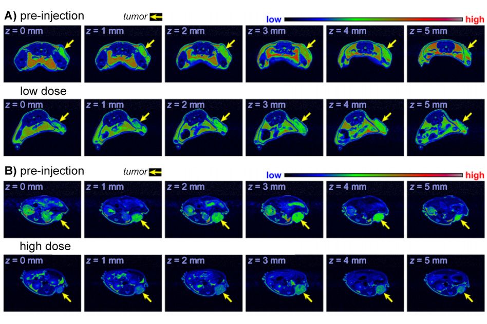 metal-free-mri-contrast-agent-could-be-safer-for-some-patients-mit