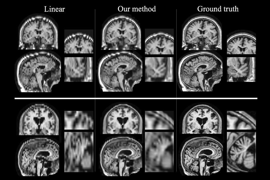 New makes brain scans better | MIT News | Institute Technology
