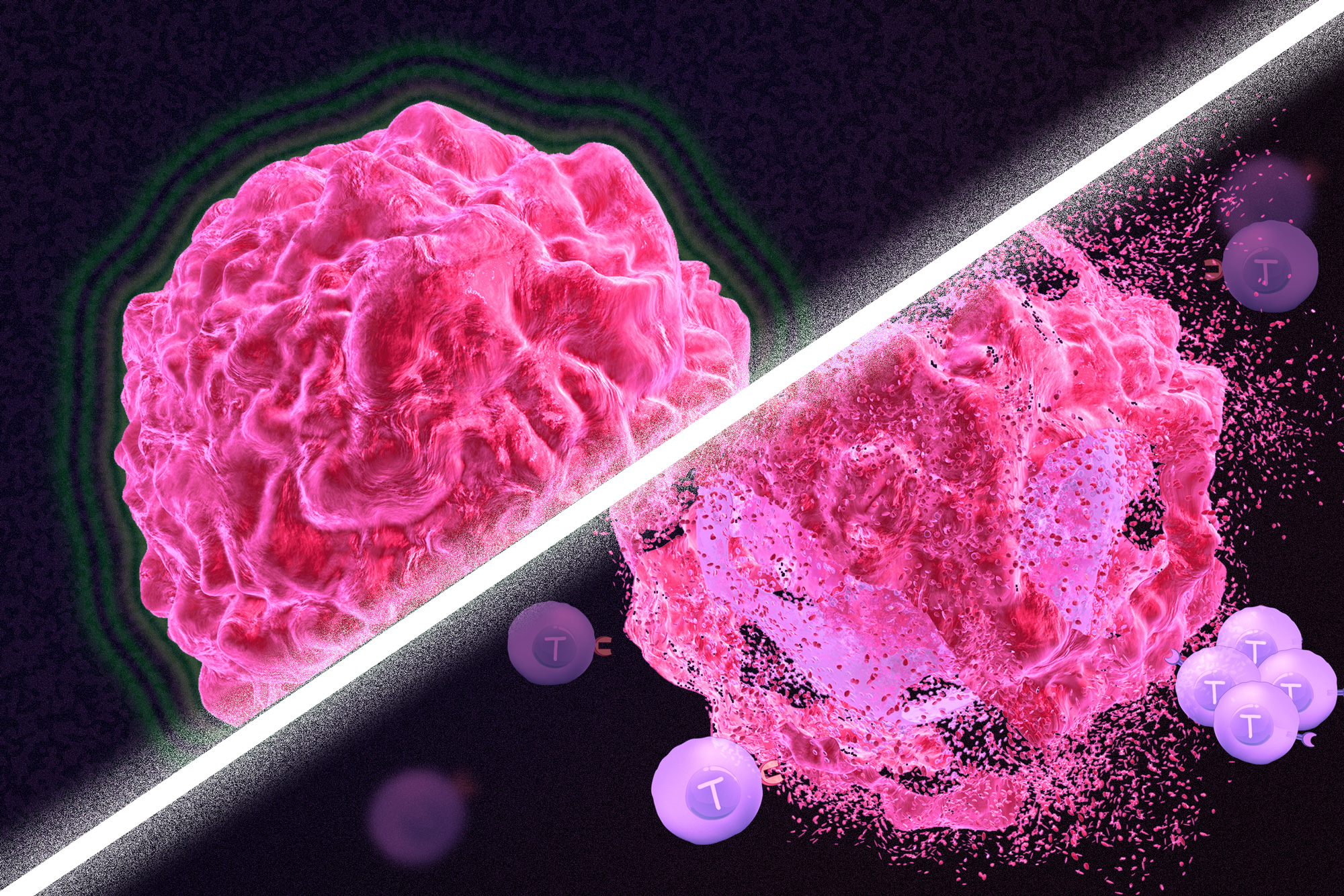 Physics - Physics of Cancer Takes Shape