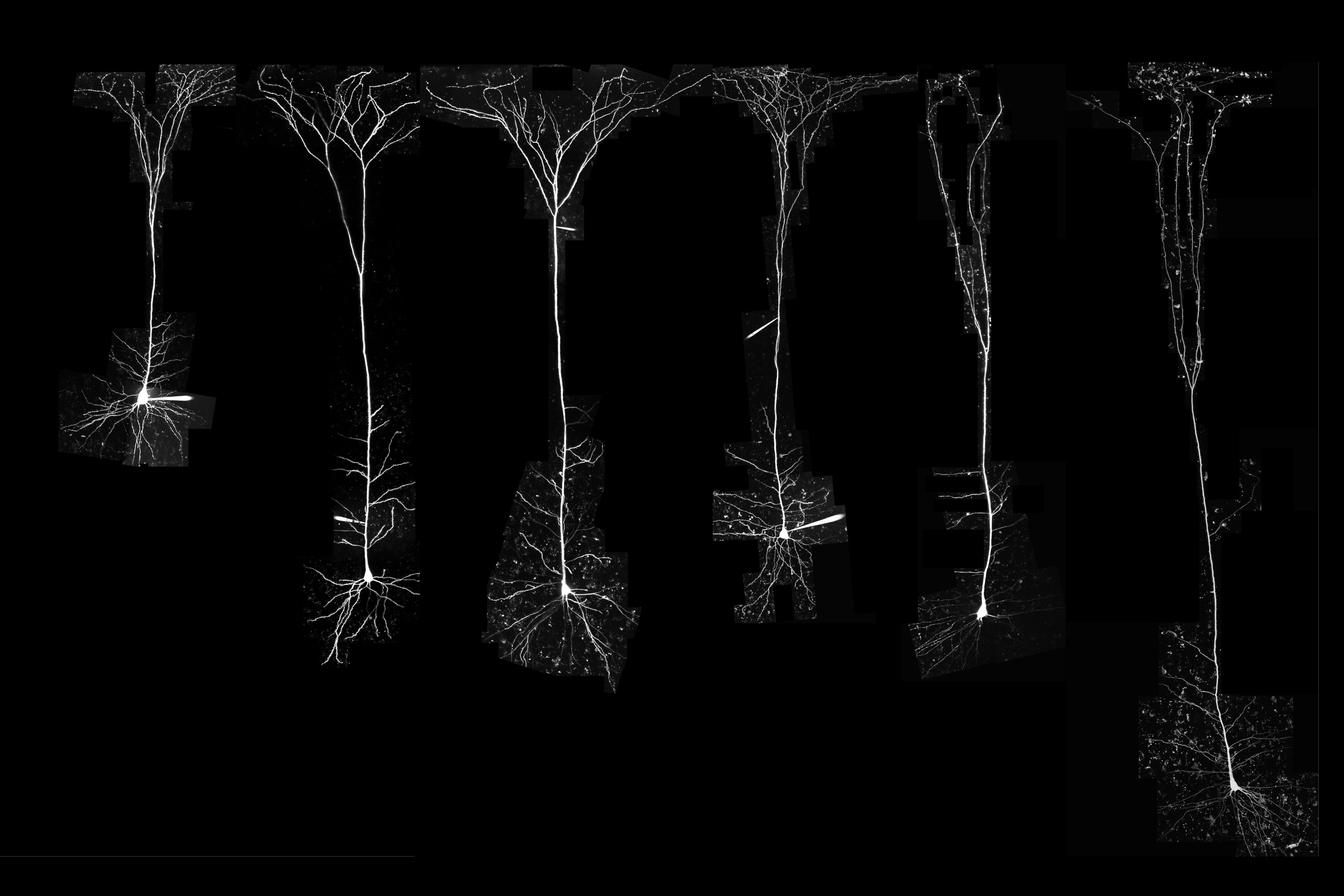 Study Finds A Striking Difference Between Neurons Of Humans And Other 