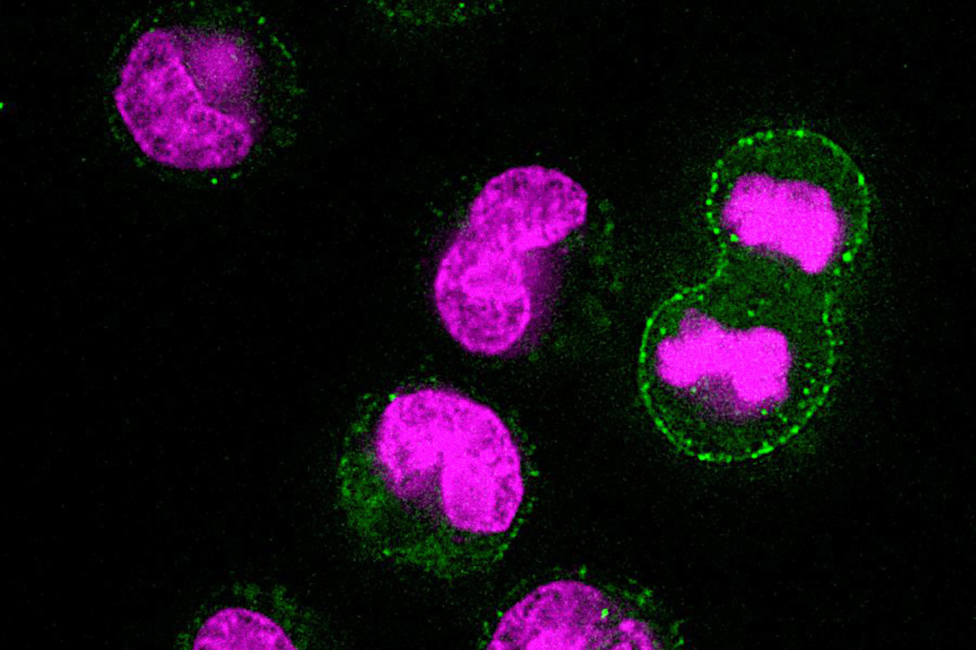 Study finds cells take out the trash before they divide - MIT News