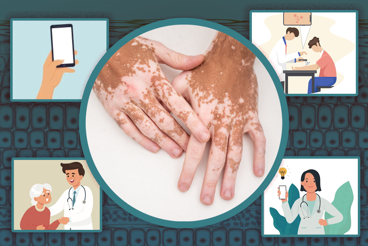 Startup lets doctors classify skin conditions with the snap of a picture |  MIT News | Massachusetts Institute of Technology
