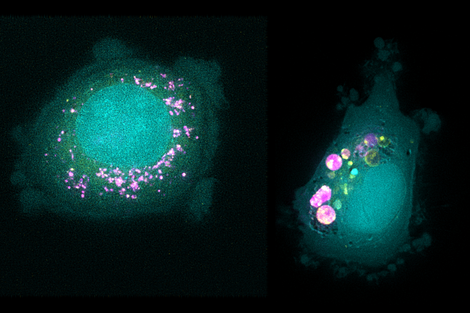 How Different Cancer Cells Respond to Drug-Delivering Nanoparticles