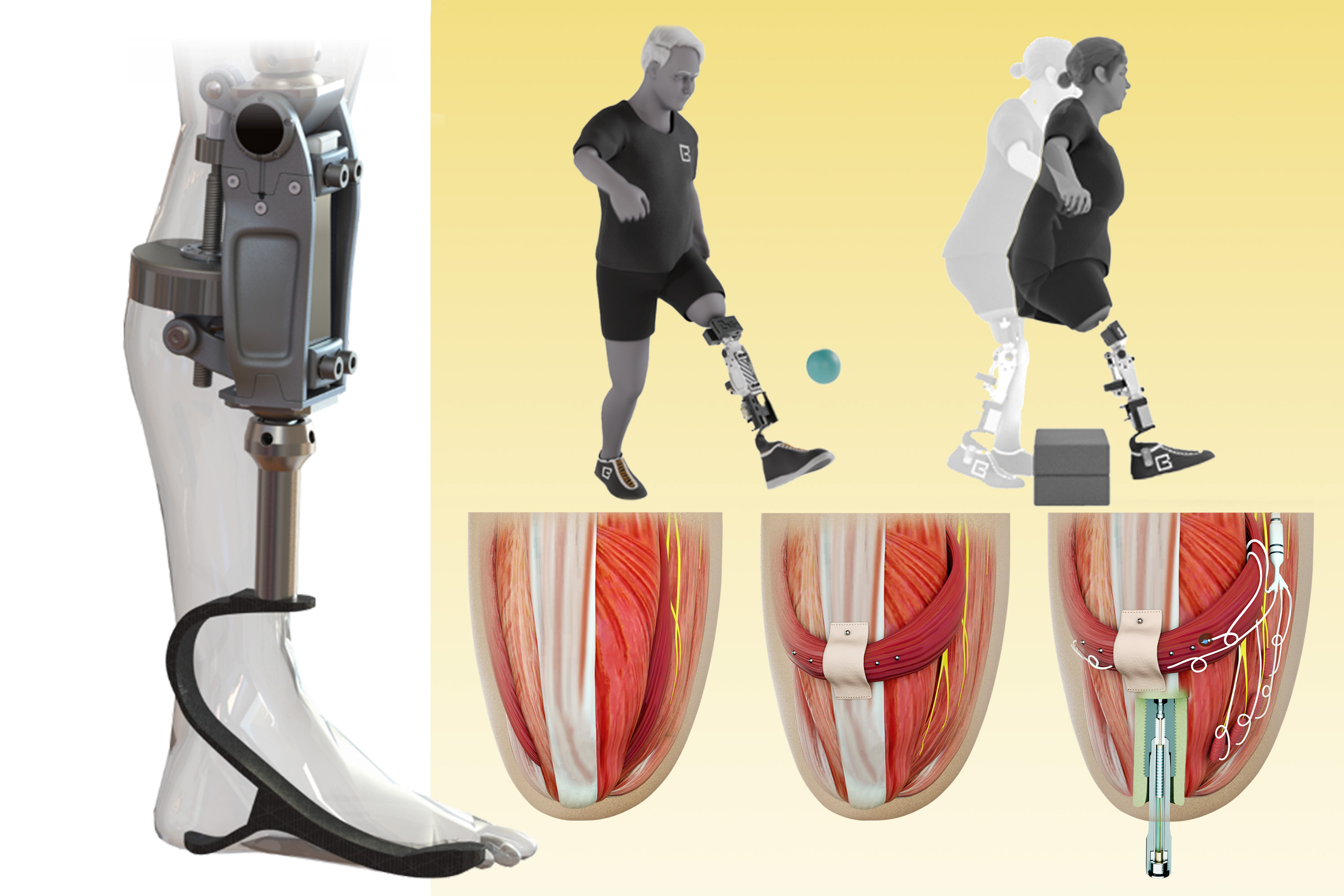 What Are The Best Prosthetic Legs