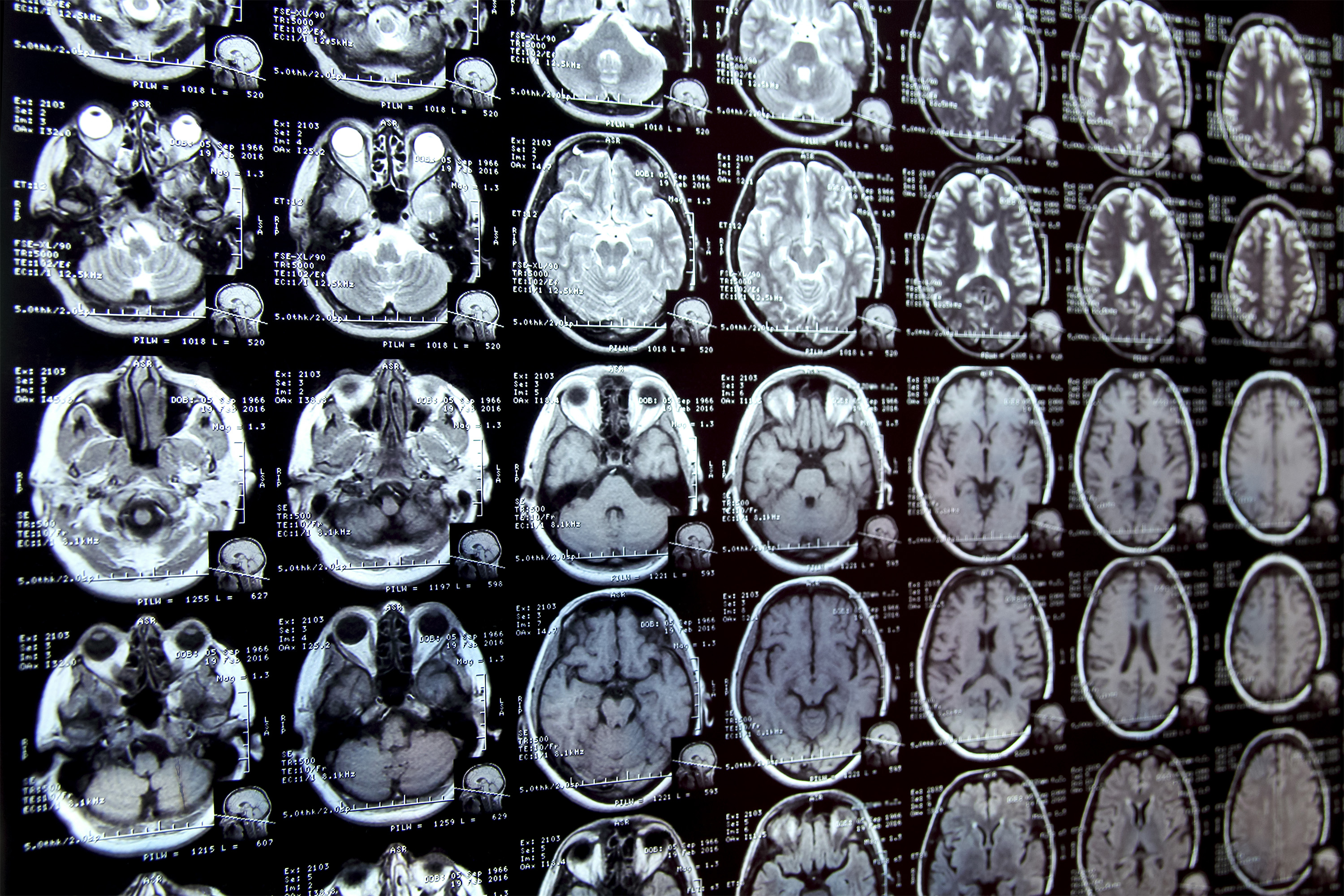 New AI system could accelerate clinical research | MIT News