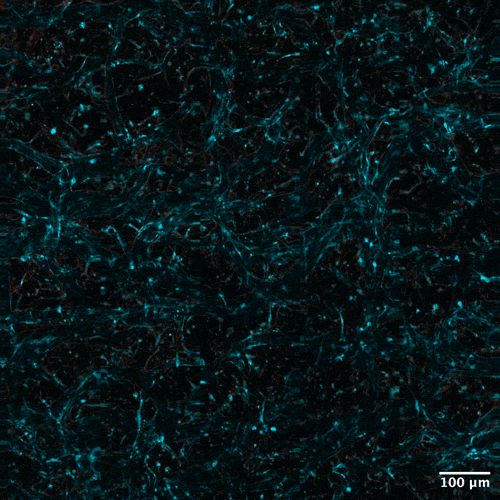 Concentrations of red dye begins to appear across the network veins.