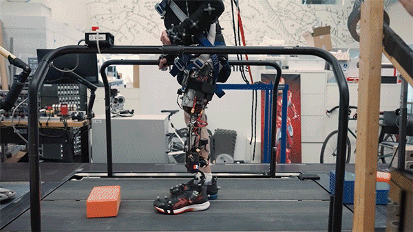 A person walks on a treadmill, moving their prosthetic leg over a foam block.