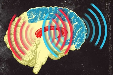 Brain with sound waves overlaid