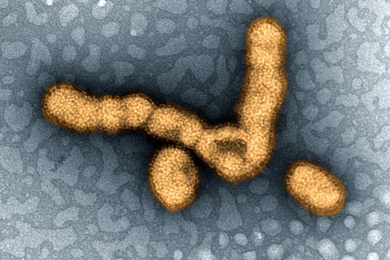Colorized transmission electron micrograph showing H1N1 influenza virus particles. 
