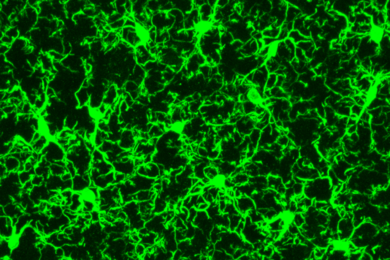 Microglia, the brain's immune cells, scavenge the brain for repairs and to remove potential infectious agents.