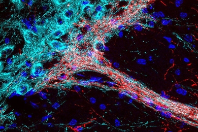 MIT neuroscientists will study the effects of phytocannabinoids on dopamine-containing neurons (turquoise) in basal ganglia circuits. These deep-brain circuits, which contain receptors that mediate the effects of cannabis, are known to influence mood and decision-making processes.