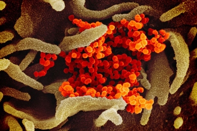 This scanning electron microscope image shows SARS-CoV-2 (orange)—also known as 2019-nCoV, the virus that causes COVID-19—isolated from a patient in the U.S., emerging from the surface of cells (green) cultured in the lab.