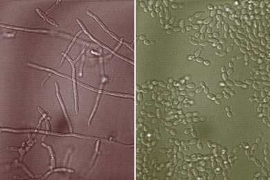 the yeast Candida albicans and mucin glycans