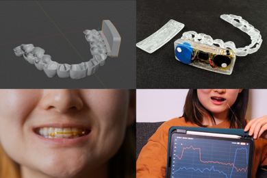 Two by two grid showing MouthIO at different stages: 3D model of the electronic dental brace, clear physical brace, a user smiling while wearing it, and a user wearing the brace connected to a tablet