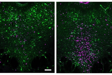 Side-by-side micrographs show the same region of brain cells lit up in green and/or magenta. There is much less magenta in the image on the left compared to the one on the right.
